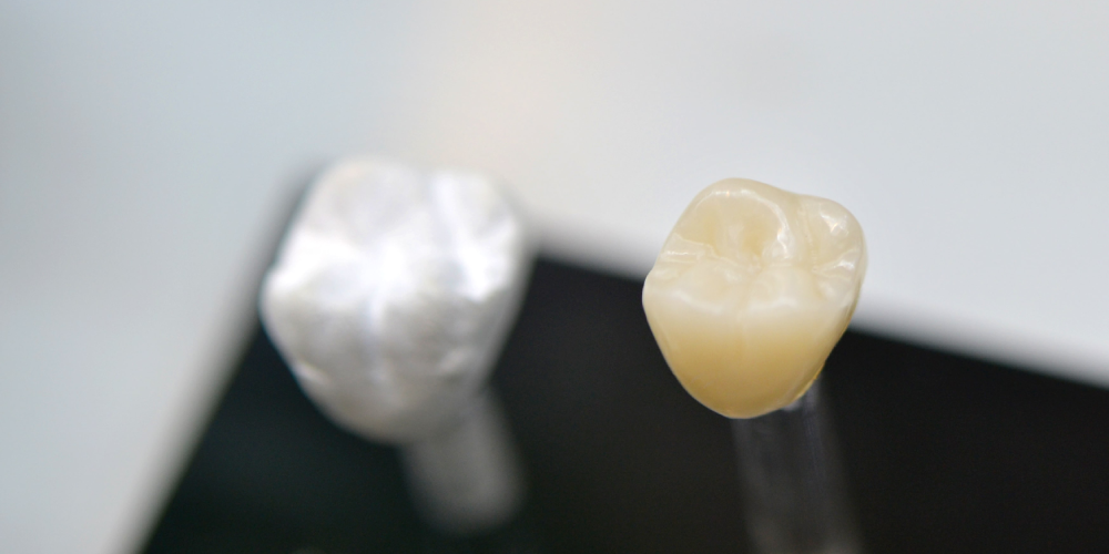 zirkonyum-dis-ne-ise-yarar zirkonyum diş ne işe yarar