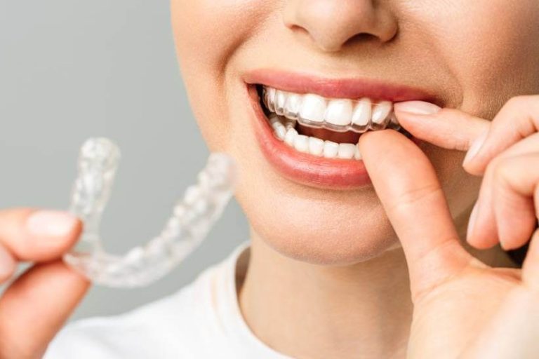 Splint Tedavisi Ne Kadar Sürer