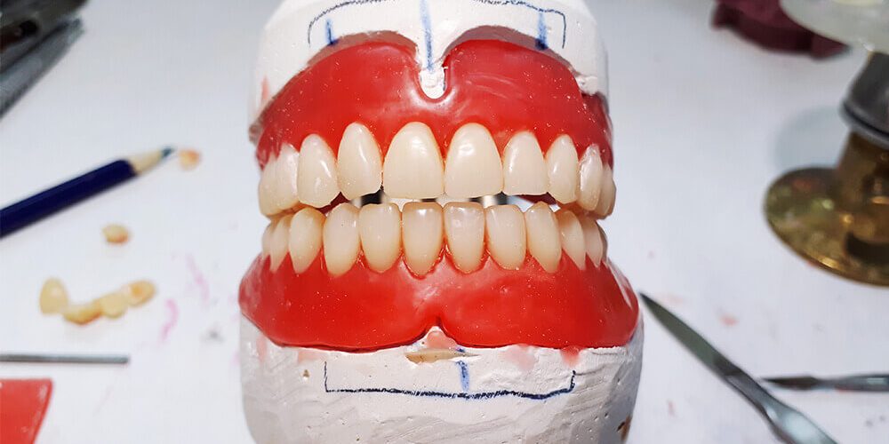 tam-agiz-implant tam ağız implant