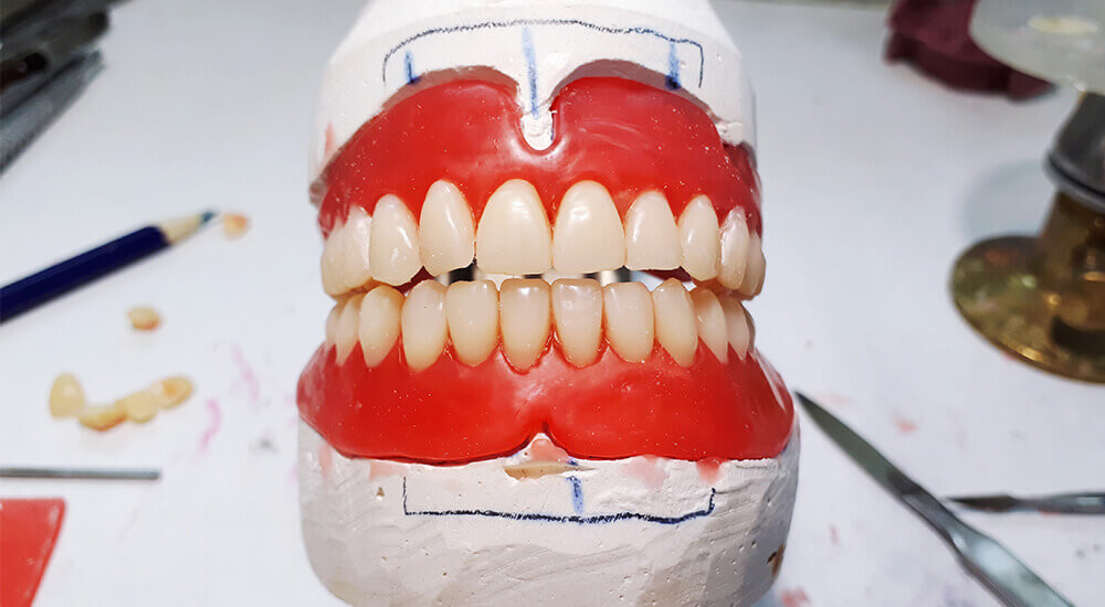 tam-agiz-implant tam ağız implant