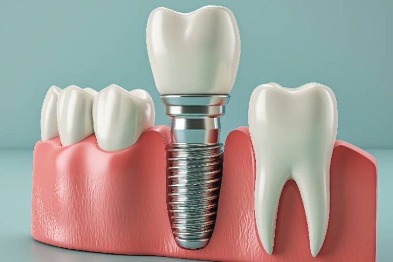 İmplant Hangi Durumlarda Yapılmaz