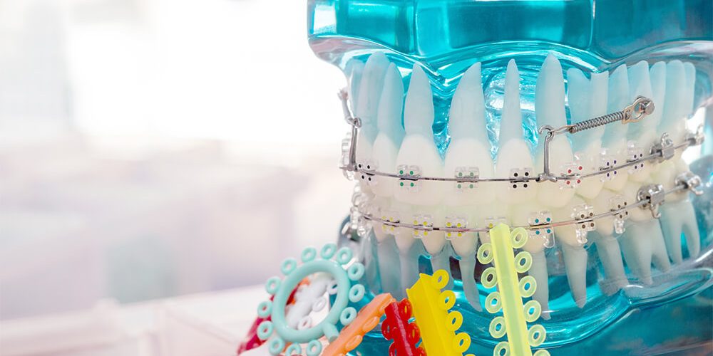 dis-kaymasi-aparatii