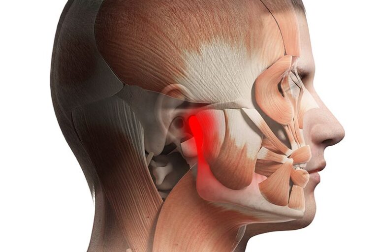 çene kütlemesi neden olur