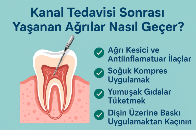 kanal tedavisi sonrası yaşanan ağrılar nasıl geçer