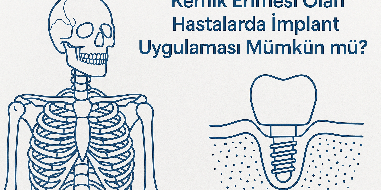kemik-erimesi-olan-hastalarda-implant-uygulamasi-mumkun-mu kemik erimesi olan hastalarda implant uygulaması mümkün mü
