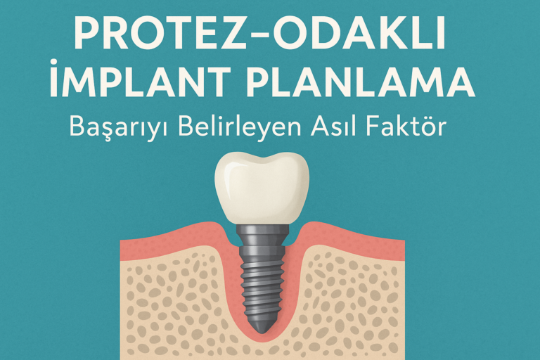 protez odaklı implant planlama