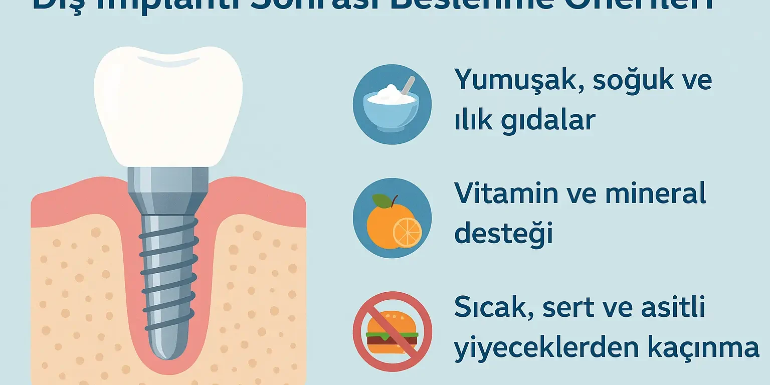 dis-implanti-sonrasi-beslenme-onerileri diş implantı sonrası beslenme