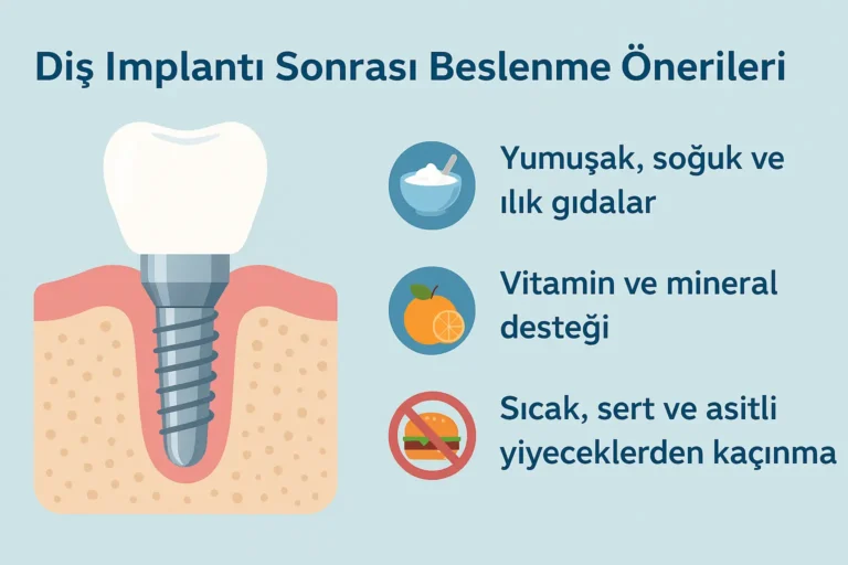 diş implantı sonrası beslenme