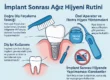 implant sonrası ağız hijyen rutini