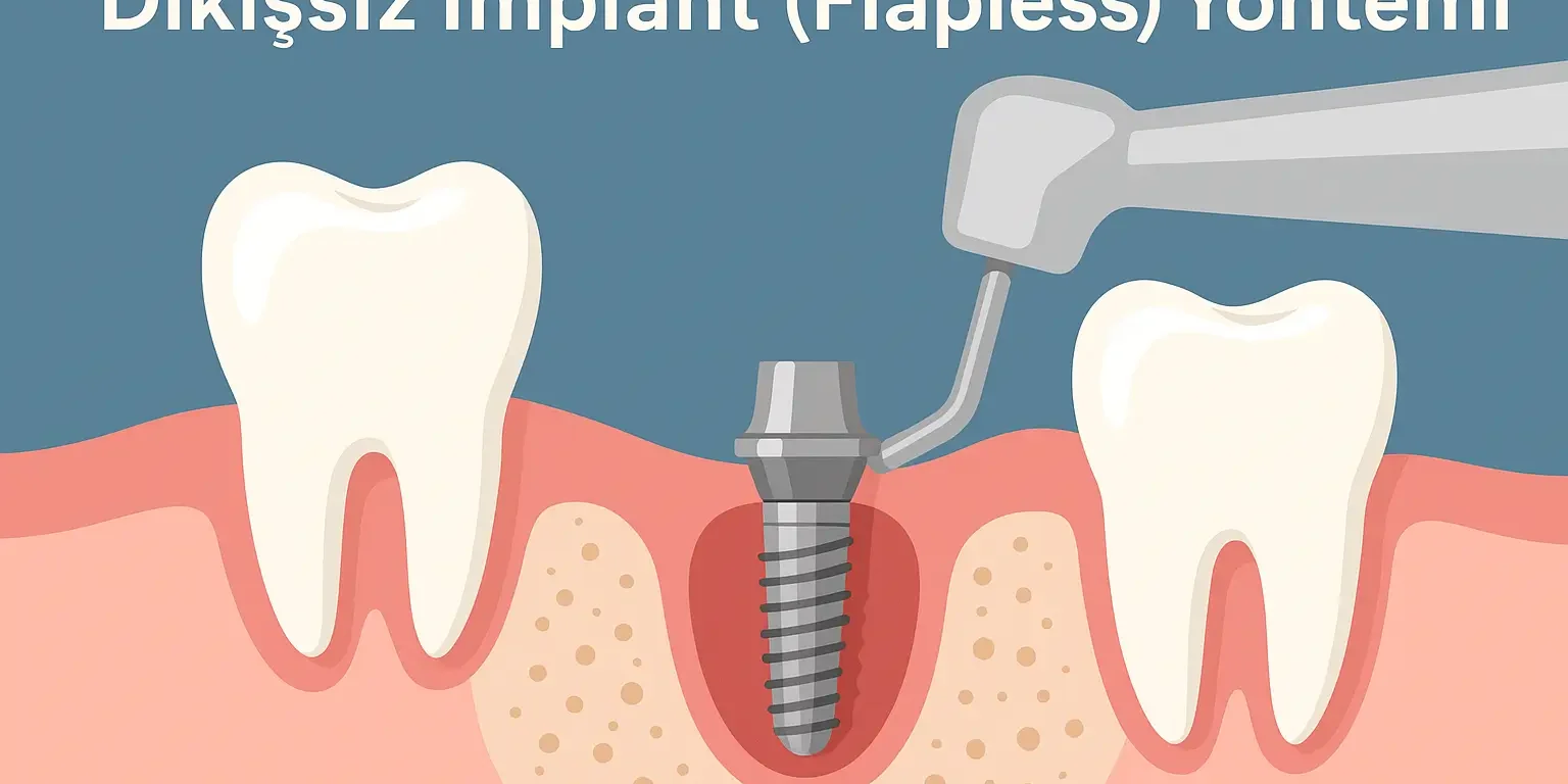 dikişsiz flapless implant nedir ve avantajlları uygulama süreci detayları