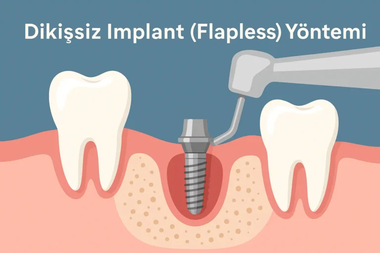 dikişsiz flapless implant nedir ve avantajlları uygulama süreci detayları