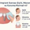 implant sonrası şişlik, morarma ve kanama normal mi