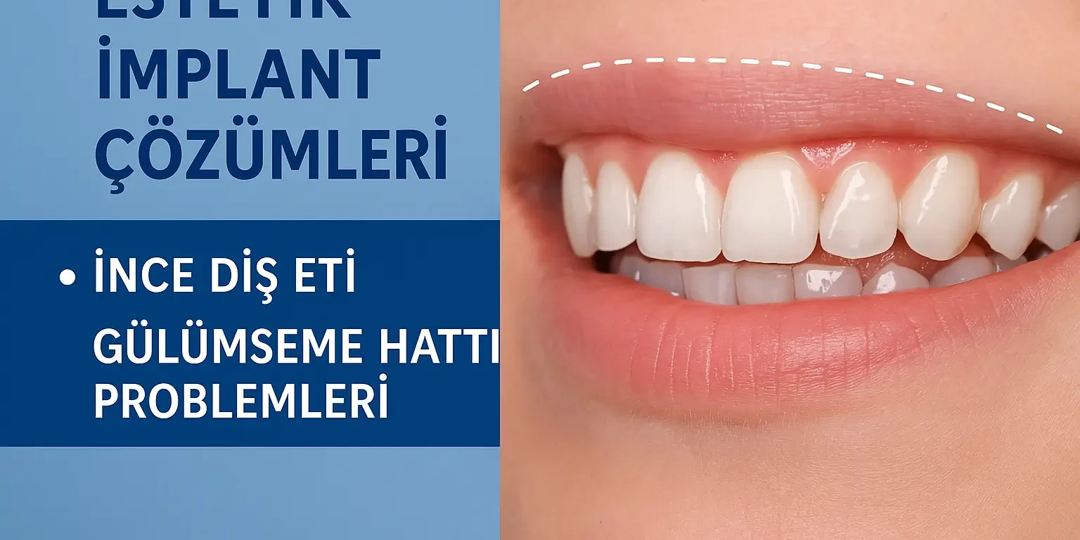 estetik implant çözümleri