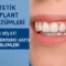 estetik implant çözümleri