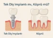 tek diş implantı mı yoksa köprü mü