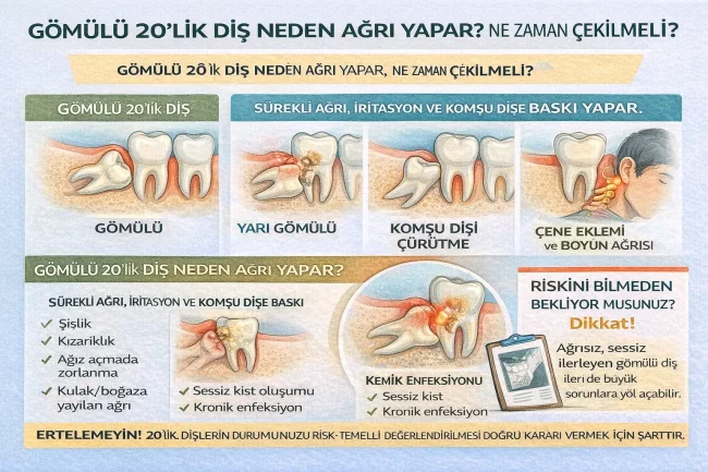 yirmilik diş neden ağrı yapar, ne zaman çekilir