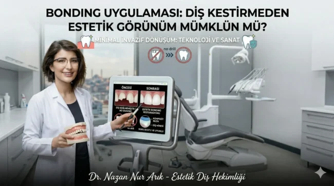 bonding-uygulamasi-dis-kestirmeden-estetik-gorunum-mumkun-mu