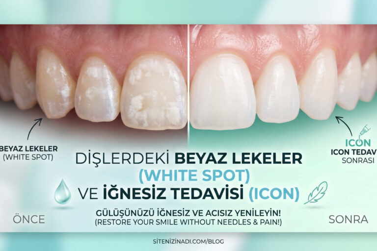 dişlerdeki beyaz lekeler, whit spot ve iğnesiz tedavi